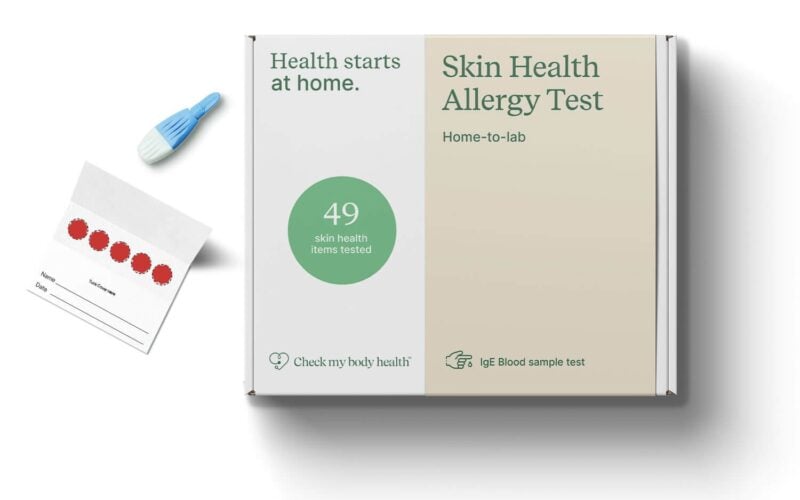Is Your Skin Trying to Tell You Something? Discover the Check My Body Health Skin Allergy Test