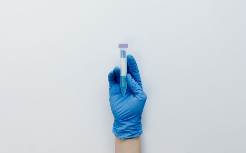 AlphaBiolabs Explains What to Know Before Taking a DNA Test